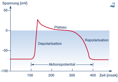 Das Bild zeigt eine EKG-Ver�nderung.