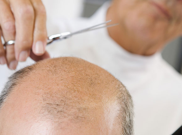 El aceite de coco la aplicación en la cosmetología para la persona y el cabello las revocaciones
