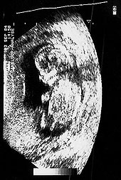 Ultraschallfoto
