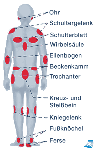 dekubitusstellen