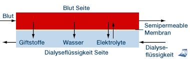 Dialyse Diagramm