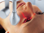 Das Bild zeigt eine Augenlaseroperation.