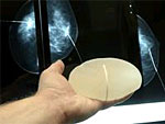 Man sieht ein Brustimplantat und im Hintergrund ein Mammographie-Bild.