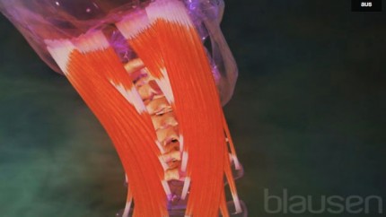 La raison de lapparition de la hernie dans le service cervical