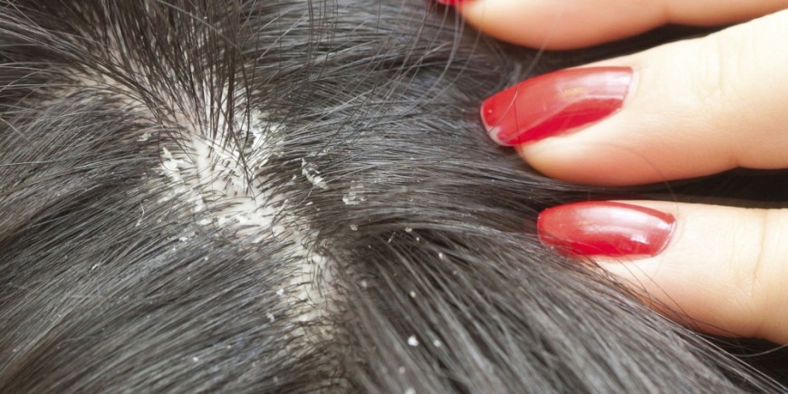 Lhuile volatile de la noix de muscade lhuile pour les cheveux