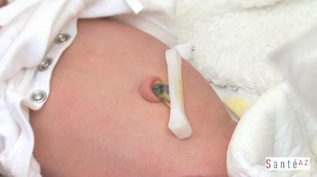 Du psoriasis le moyen