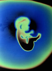 Pr&auml;nataldiagnostik: Embryo in Fruchtblase