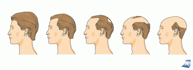 Die Maske für das Haar aus den Mandelöl