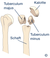 Anatomie des Humeruskopfs