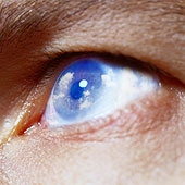 Hypnotisiertes Auge