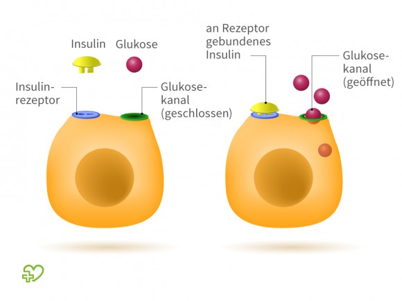 Die ursachen von diabetes
