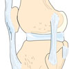 Anatomie des Kniegelenks