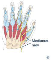 Medianusnerv in der Hand