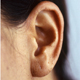 Tinnitus durch Hilfszellen?
