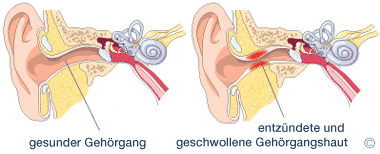 Anatomie des menschlichen Ohres