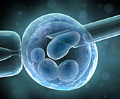 Die Präimplantationsdiagnostik (PID) soll genetisch belasteten Paaren zu einem gesunden Kind verhelfen. Zellentnahme aus einem Embryo