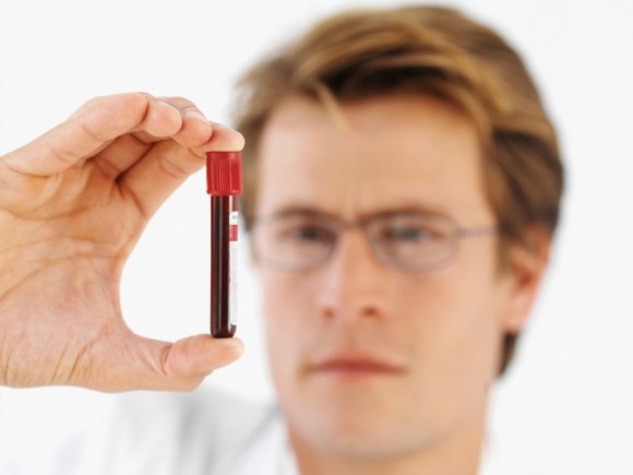 Die Salbe bei die Hämorrhoide bei der Schwangerschaft
