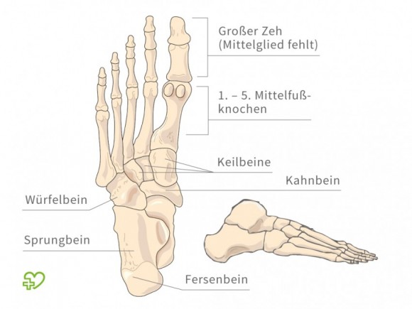 Die Apotheke das Mittel von gribka der Nägel