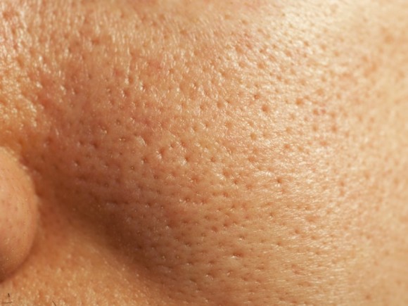 Ob die Pigmentflecke auf den Beinen gefährlich sind