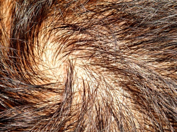 Die Maske für das Haar aus den Eiern und das Öl oliven-