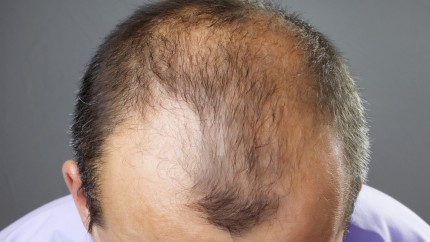 Die Mittel für das Haar in den Apotheken das Sortiment