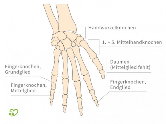Die Behandlung des Nagelzwanges petrosawodsk