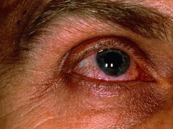 Die Masken für die Person von aller bude den Gute