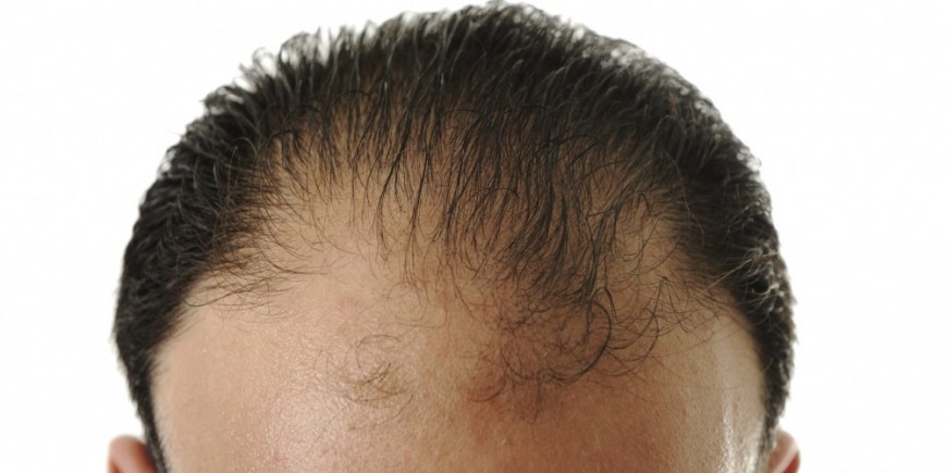 Die Rezensionen über die Maske für das Haar resche