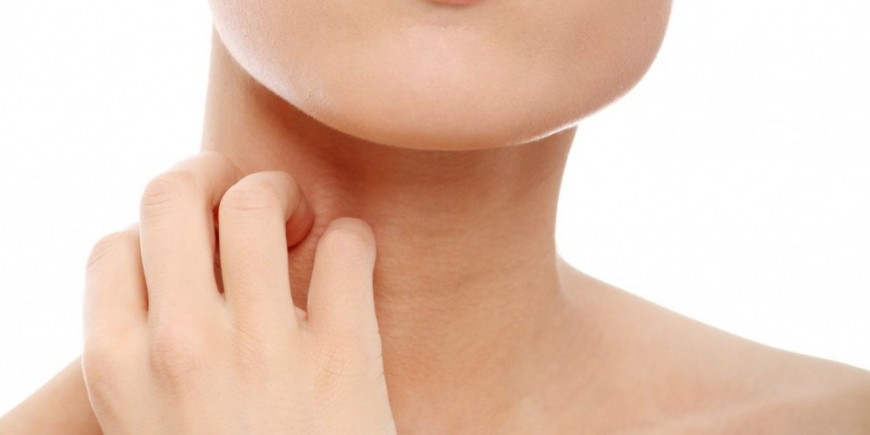 Como se desarrolla la psoriasis