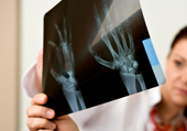 Eine Frau h�lt ein R�ntgenbild einer Hand. 
