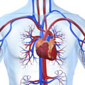 Arteriosklerose