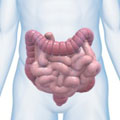 C&aacute;ncer de colon