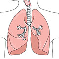 Chronisch obstruktive Bronchitis