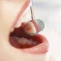 Enfermedades dentales