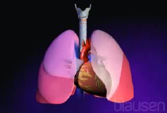 Fumar, factor de riesgo importante para el c�ncer de pulm�n