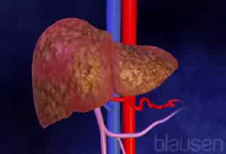 Los virus y el alcohol son posibles causas