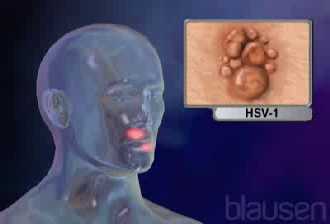 �Contagioso o no?