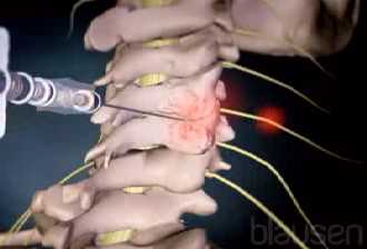 Dan flexibilidad a la columna vertebral
