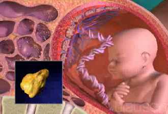 Complicaci�n frecuente