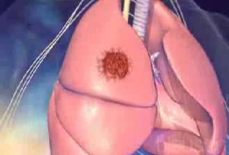 �C�mo se originan las c�lulas cancer�genas?