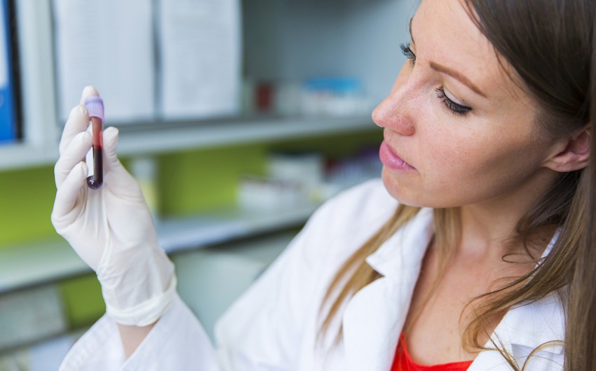 Bauchspeicheldrüsenentzündung: Eine Ärztin betrachte eine Teströhrchen mit Blut.