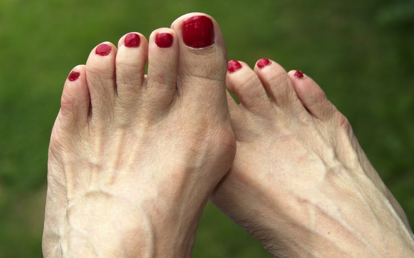 Hallux Valgus Besser Auf High Heels Verzichten Onmeda De