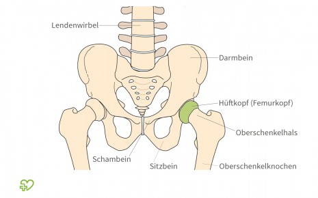 Illustration: Anatomie des Beckens mit Darstellung des Hüftkopfs