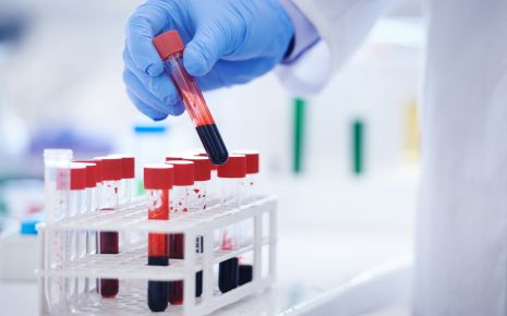 Nierenwerte Wann Sind Sie Zu Hoch Tabelle Onmeda De