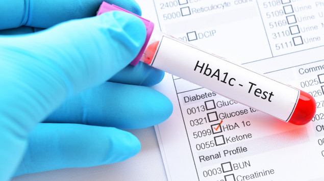 Man sieht eine Blutprobe für einen HbA1c-Bluttest.