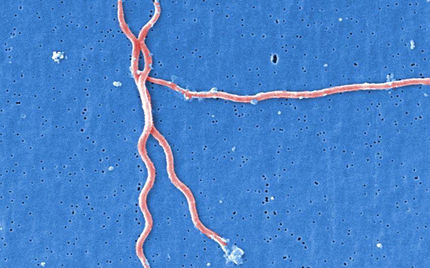 Borreliose: Man sieht eine Aufnahme von Borrelia burgdorferi mit dem Rasterelektronenmikroskop.