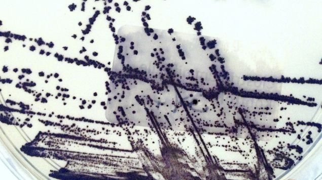 Clostridium difficile-Kultur
