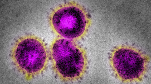 Ein Coronavirus unter dem Mikroskop: Coronaviren sind meist harmlos, es gibt aber auch Arten, die schwerwiegende Erkrankungen auslösen können.