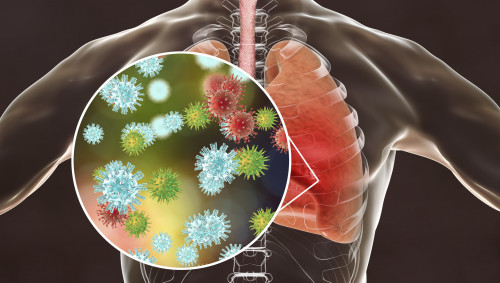 coronavirus, lungenerkrankung