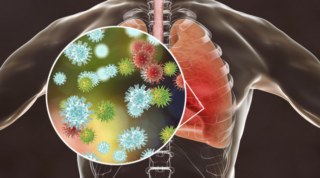 coronavirus, lungenerkrankung